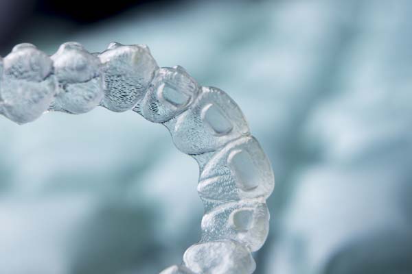 FAQs: Clear Aligners For Adults