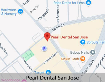 Map image for Why Dental Sealants Play an Important Part in Protecting Your Child's Teeth in San Jose, CA